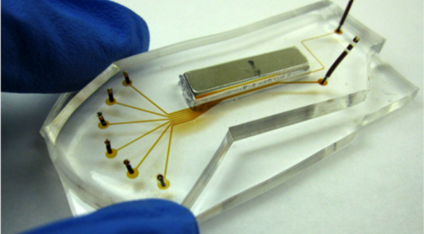 Cell Enrichment Microfluidic Chip for Lung Cancer Cell Counting